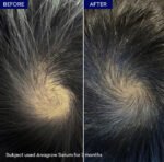 Anagrow Hair Shampoo – Anti Hair Fall & Hair Growth Formula - Image 3