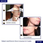 NiaRonic Serum (Pore Minimizing) - 20ml - Image 2