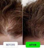 Anagrow Hair Shampoo – Anti Hair Fall & Hair Growth Formula - Image 2