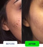 MandelAC Facewash - 100ml - Image 2